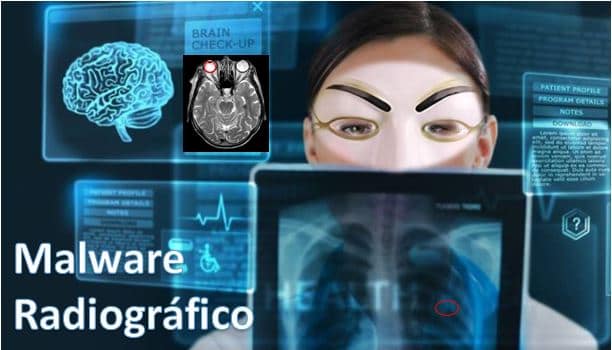 Desarrollan malware que hace que aparezcan tumores en radiografías